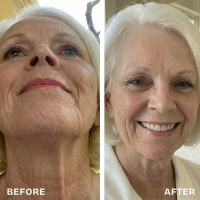 Renovia™ Cyperus Rotundus Skin Serum | Stop Unwanted Hair Growth Naturally