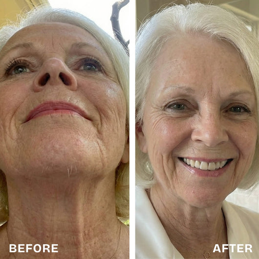 Renovia™ Cyperus Rotundus Skin Serum | Stop Unwanted Hair Growth Naturally