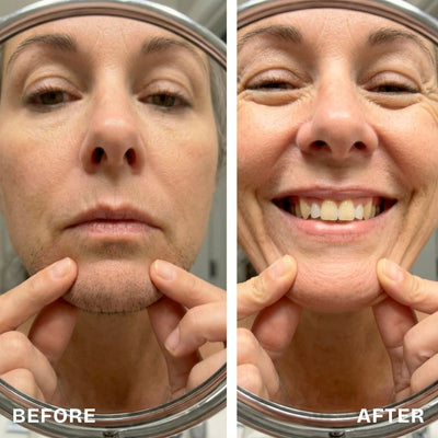 Renovia™ Cyperus Rotundus Skin Serum | Stop Unwanted Hair Growth Naturally