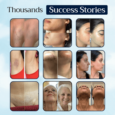 Renovia™ Cyperus Rotundus Skin Serum | Stop Unwanted Hair Growth Naturally